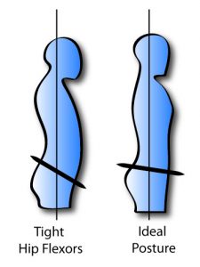 Excessive arching in back, bulging belly, sunken chest and a butt that sticks out.